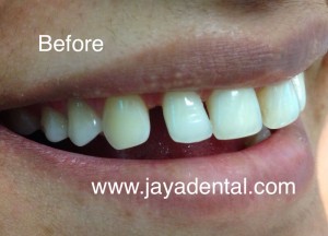 96444fa5fd90b9076838c27f72c11238